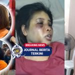 Video ART di Batam Babak Belur Dianiaya Majikan & Rekan Kerja! Wajah Bonyok Kini Terbaring di RS