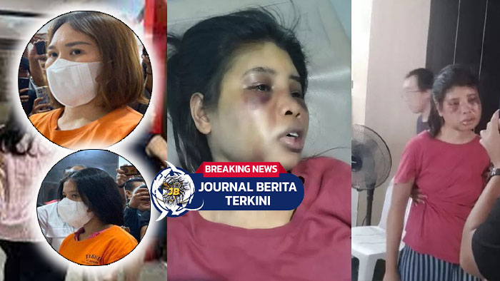 Video ART di Batam Babak Belur Dianiaya Majikan & Rekan Kerja! Wajah Bonyok Kini Terbaring di RS