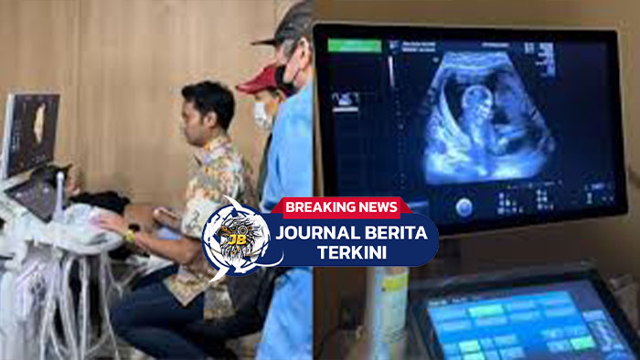 [VIDEO] Unggah Momen Periksa Kandungan Calon Buah Hati, Erika Carlina: Mohon Perlindungan