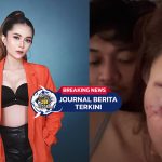 [VIDEO] Alami Luka M3m4r di Wajah! DJ di Malang Dianiaya Pacar Lapor Polisi